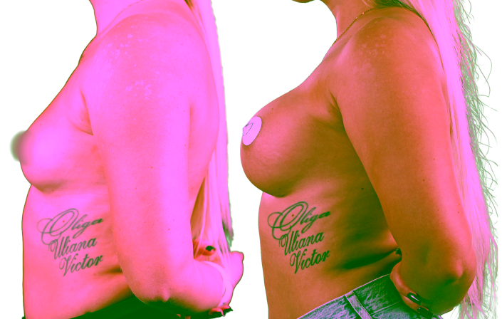 img 1486 1 Chirurgie Plastiсă, Estetică, Microchirurgie Reconstructivă si Chirurgia Mâinei