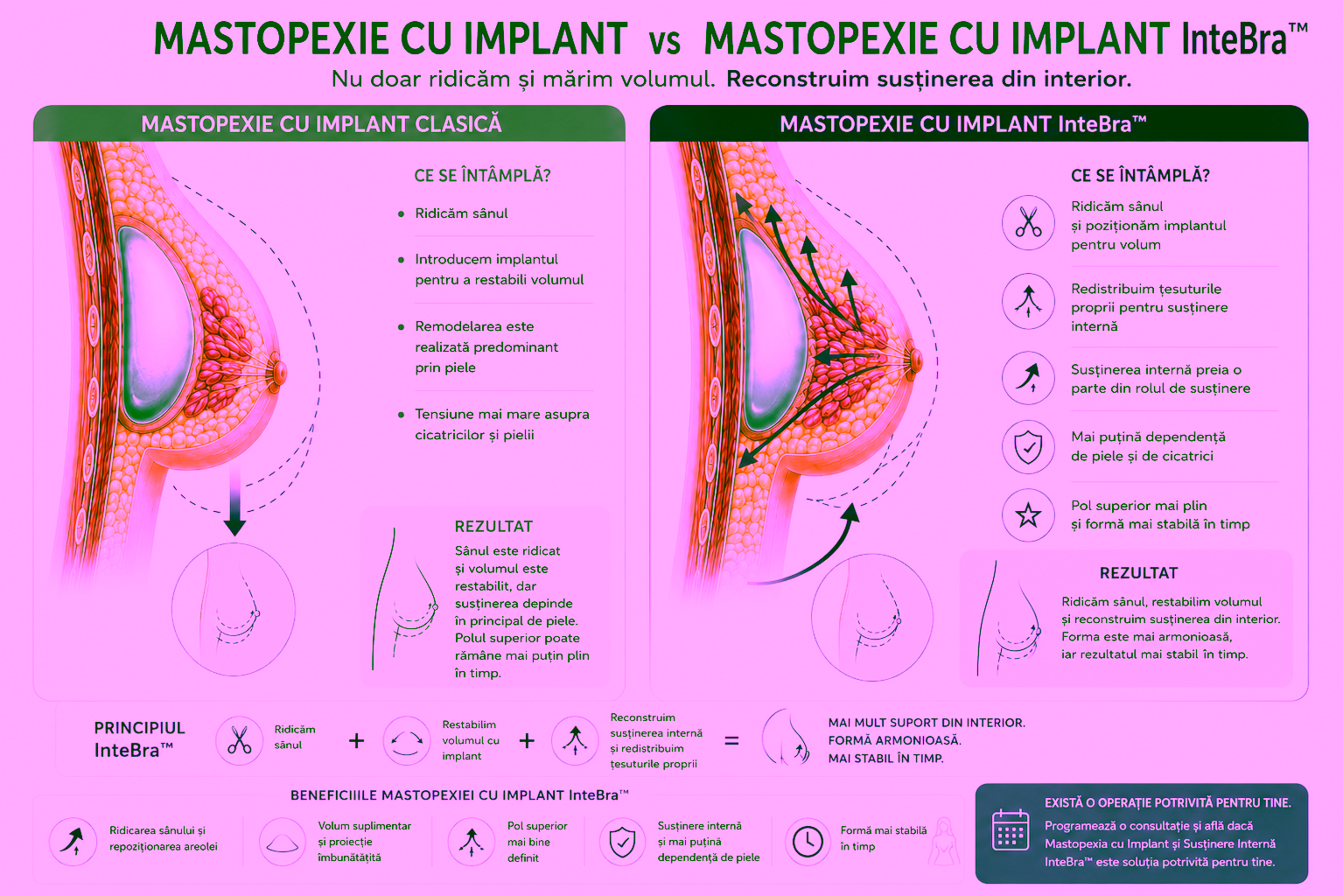 Mastopexie cu Implant și Susținere Internă InteBra™ în Chișinău 1
Mastopexie cu Implant și Susținere Internă InteBra™ în Chișinău | Dr. Olesea Cătarău & Dr. Maxim Melenciuc