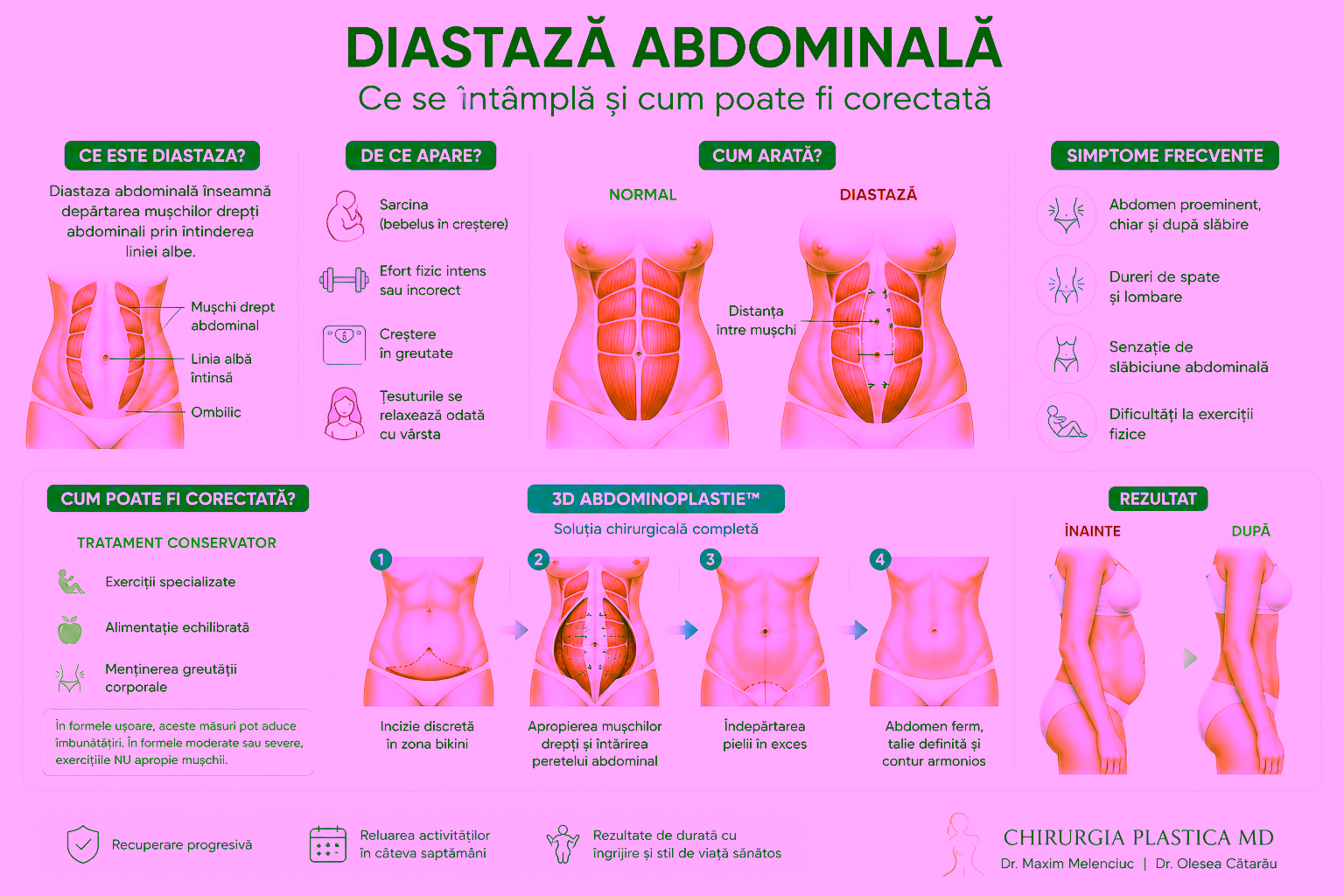 Diastază abdominală în Chișinău | Tratament modern și 3D Abdominoplastie™| dr Olesea Catărău &Maxim Melenciuc Diastază abdominală în Chișinău | Tratament modern și 3D Abdominoplastie™| dr Olesea Catărău &Maxim Melenciuc