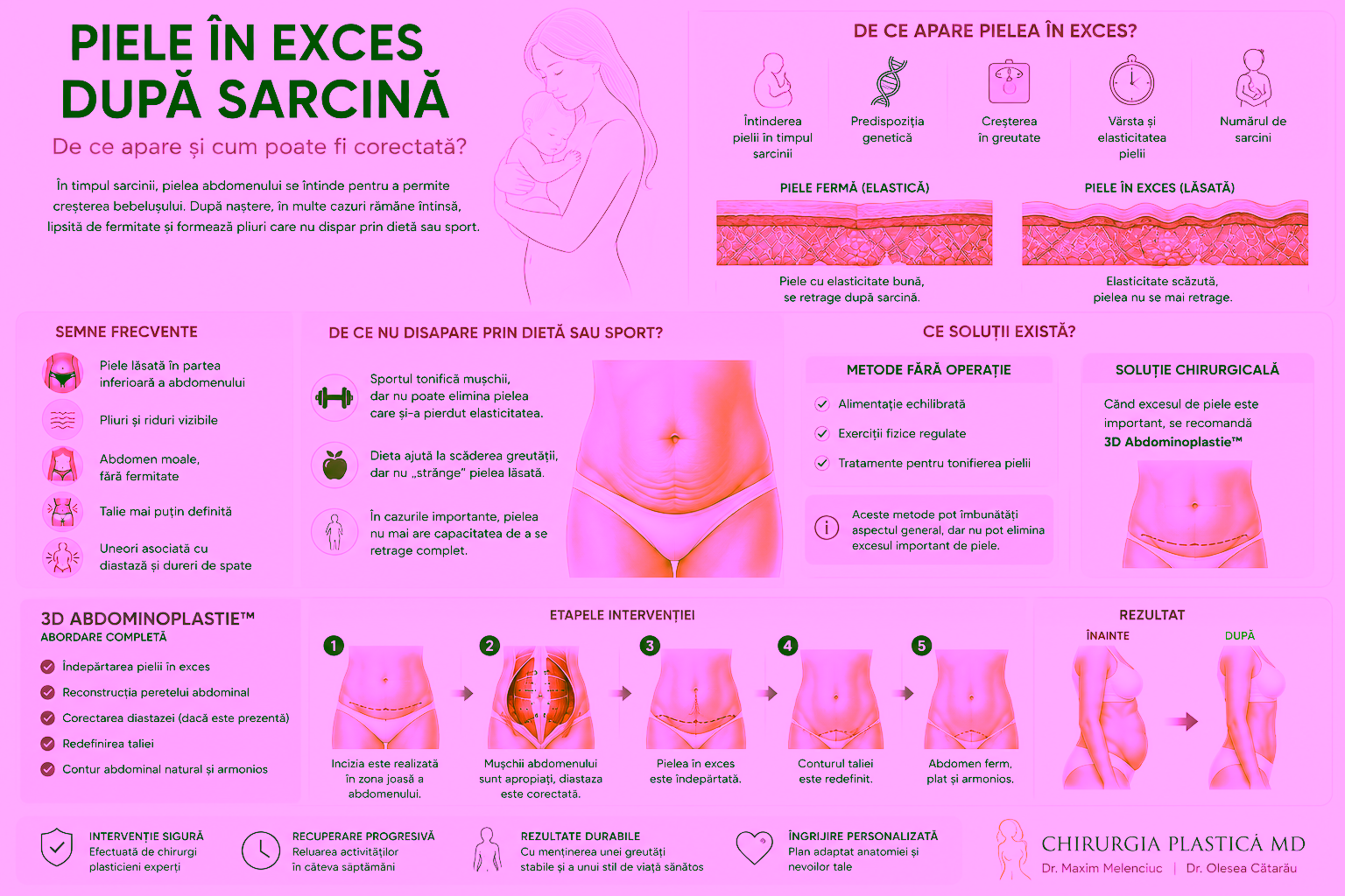 Piele în exces după sarcină în Chișinău | Tratament și 3D Abdominoplastie™ 1 Piele în exces după sarcină în Chișinău | Tratament și 3D Abdominoplastie™ Dr Olesea Catărău & Maxim Melenciuc