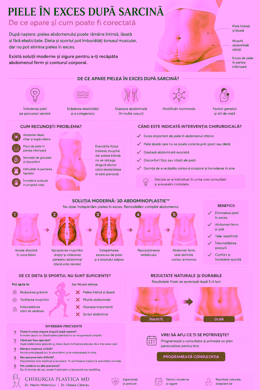 Piele în exces după sarcină în Chișinău | Tratament și 3D Abdominoplastie™ Dr Olesea Catărău & Maxim Melenciuc Piele în exces după sarcină în Chișinău | Tratament și 3D Abdominoplastie™ Dr Olesea Catărău & Maxim Melenciuc