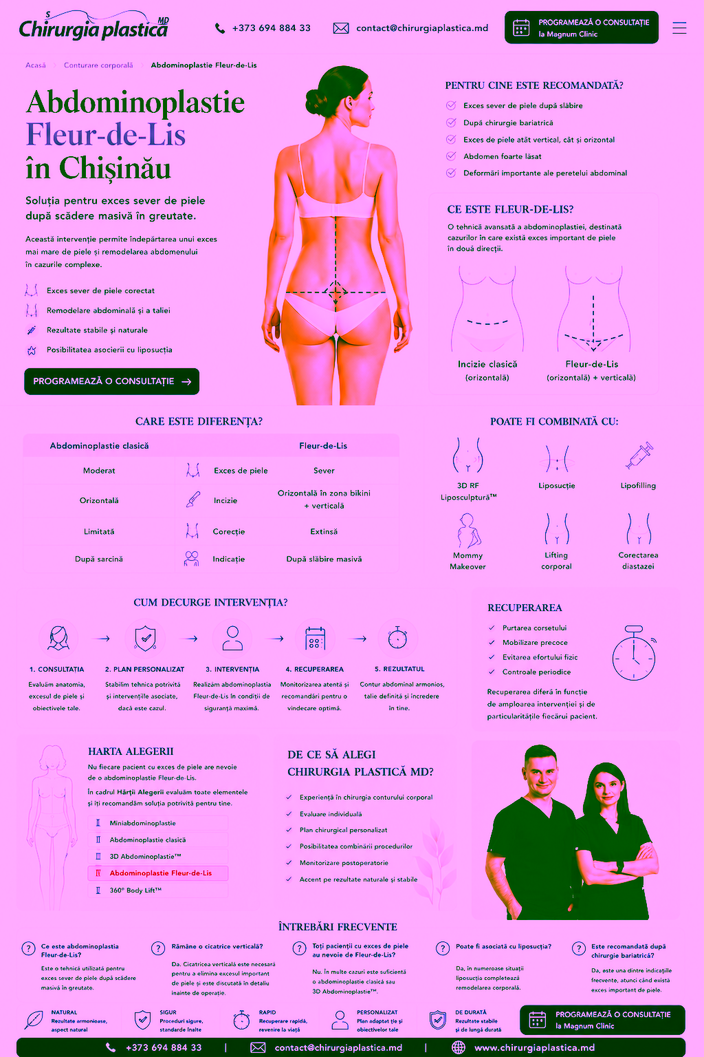 Abdominoplastie Fleur-de-Lis în Chișinău 1 abdominoplastie fleur de lys Chirurgia Plastica MD Dr Olesea Catărău & Dr Maxim Melenciuc