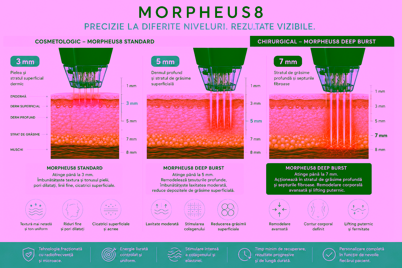 Morpheus8 Deep Burst în Moldova 1 file 00000000f71c720a88c15e5ac53012d3 Chirurgie Plastiсă, Estetică, Microchirurgie Reconstructivă si Chirurgia Mâinei